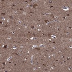 Immunohistochemical staining of human cerebral cortex shows high expression.