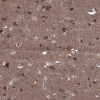 Immunohistochemical staining of human cerebral cortex shows high expression.