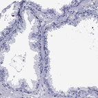 Immunohistochemical staining of human prostate shows low expression as expected.