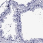Immunohistochemical staining of human prostate shows low expression as expected.