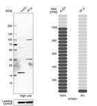 Western blot analysis in human cell line A-431 and human cell line RT-4.