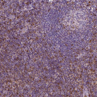 Anti-S100A4 Antibody