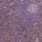 Immunohistochemical staining of human tonsil shows moderate to strong cytoplasmic positivity, mainly in non - germinal center cells.