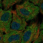 Anti-CSGALNACT1 Antibody