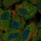 Anti-CSGALNACT1 Antibody