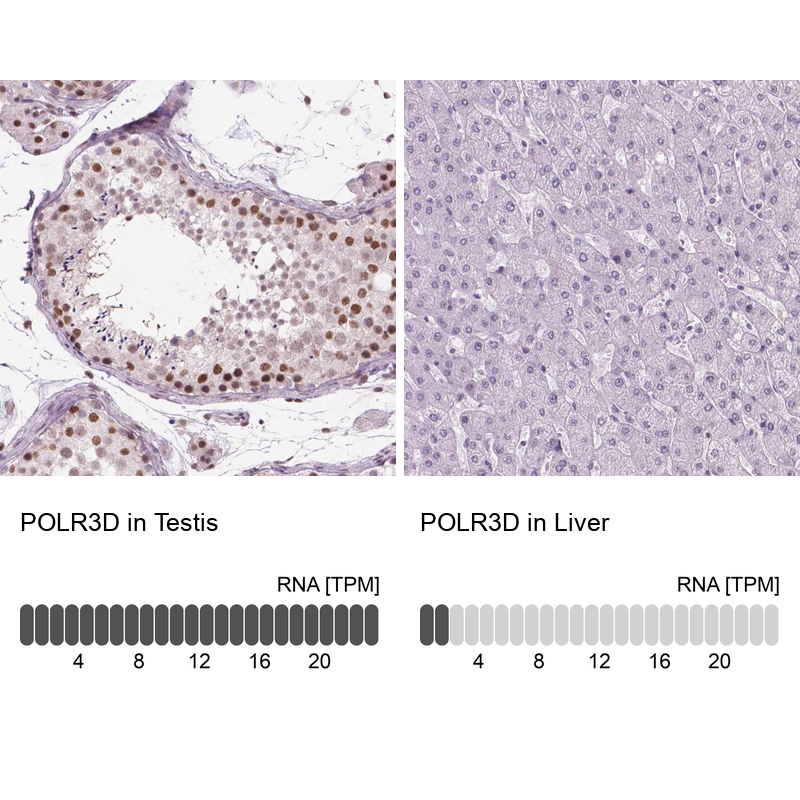 Anti-POLR3D Antibody