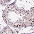 Immunohistochemical staining of human testis shows high expression.