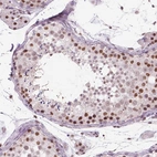Immunohistochemical staining of human testis shows high expression.