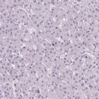 Immunohistochemical staining of human liver shows low expression as expected.
