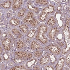 Anti-CHMP4A Antibody