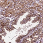 Immunohistochemical staining of human prostate shows strong granular cytoplasmic positivity in glandular and smooth muscle cells.