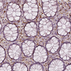 Immunohistochemical staining of human rectum shows strong cytoplasmic positivity in lymphoid cells.