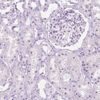 Immunohistochemical staining of human kidney shows no positivity in cells in tubules as expected.