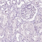 Immunohistochemical staining of human kidney shows no positivity in cells in tubules as expected.