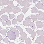 Immunohistochemical staining of human skeletal muscle shows no positivity in myocytes as expected.