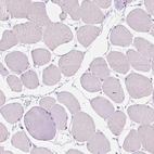 Immunohistochemical staining of human skeletal muscle shows no positivity in myocytes as expected.