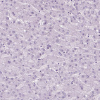 Immunohistochemical staining of human liver shows no positivity in hepatocytes as expected.