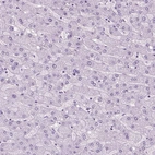 Immunohistochemical staining of human liver shows no positivity in hepatocytes as expected.