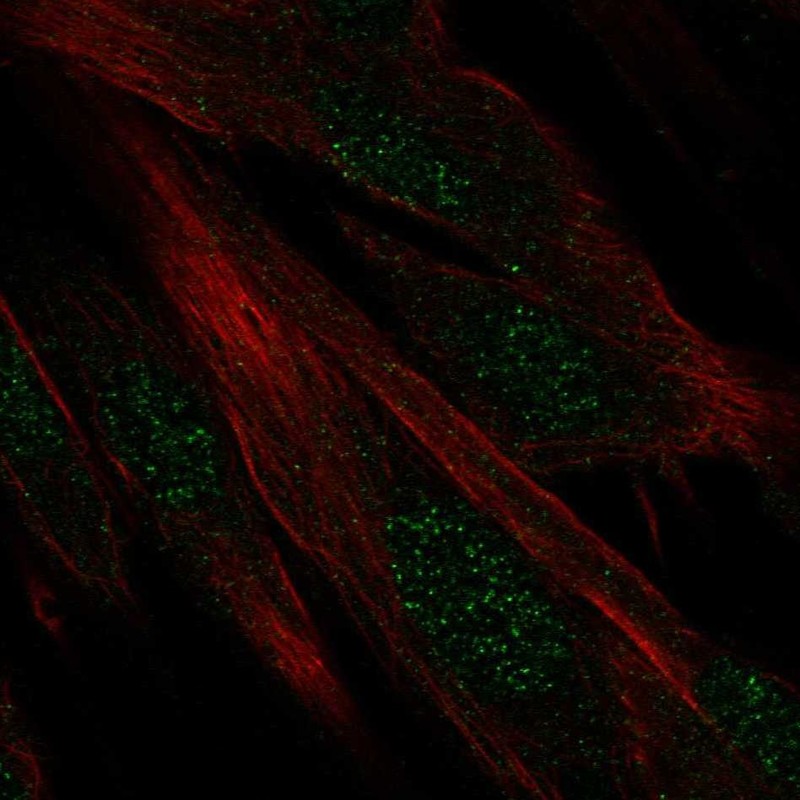 Anti-DIRC1 Antibody