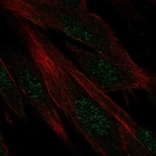 Anti-DIRC1 Antibody