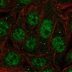 Immunofluorescent staining of human cell line MCF7 shows localization to nuclear speckles & cytoplasmic bodies.