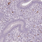 Immunohistochemical staining of human endometrium shows moderate to strong cytoplasmic positivity in lymphoid cells.