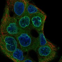 Anti-C22orf31 Antibody