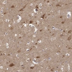 Anti-AP1B1 Antibody