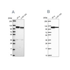 Western blot analysis using Anti-AP1B1 antibody HPA068520 (A) shows similar pattern to independent antibody HPA065226 (B).
