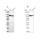 Western blot analysis using Anti-AP1B1 antibody HPA068520 (A) shows similar pattern to independent antibody HPA065226 (B).