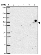 Lane 1: Marker [kDa] 250, 130, 95, 72, 55, 36, 28, 17, 10_br/_Lane 2: Human cell line RT-4_br/_Lane 3: Human cell line U-251 MG_br/_Lane 4: Human plasma_br/_Lane 5: Human Liver tissue_br/_Lane 6: Human Tonsil tissue