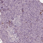 Immunohistochemical staining of human pancreas shows no positivity in either islets of Langerhans or exocrine glandular cells as expected.