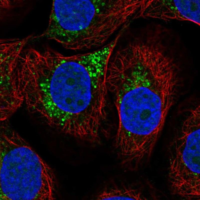 Anti-LAPTM4A Antibody