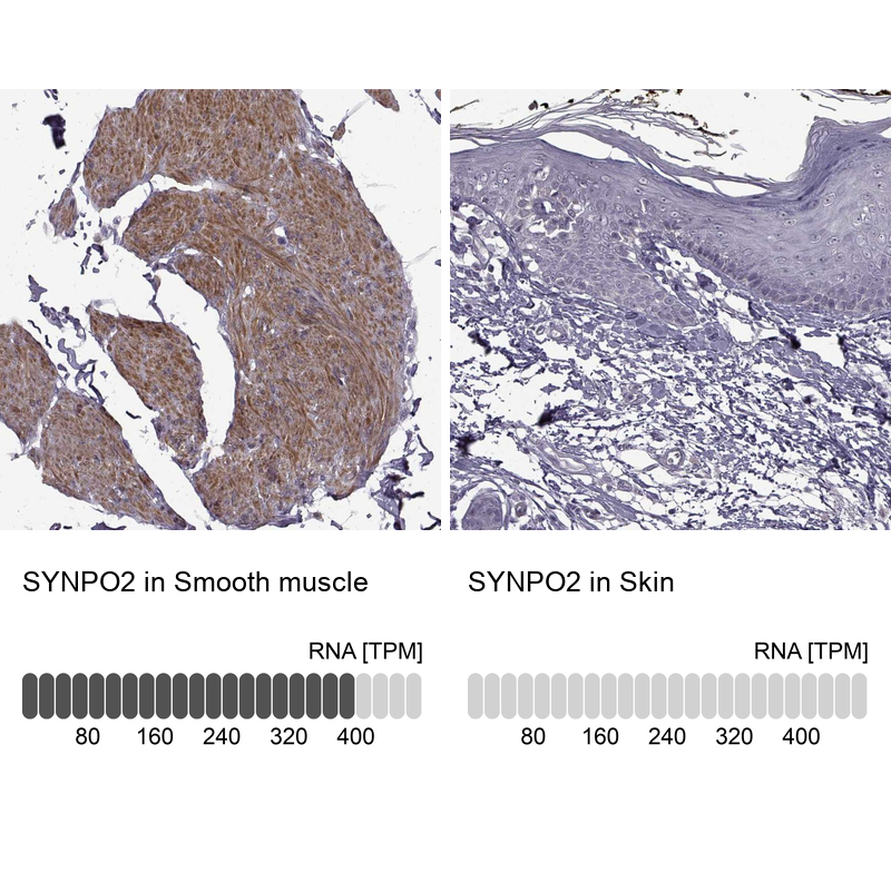 Anti-SYNPO2 Antibody