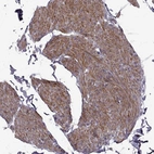 Immunohistochemical staining of human smooth muscle shows high expression.