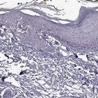 Immunohistochemical staining of human skin shows low expression as expected.