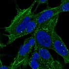 Immunofluorescent staining of human cell line SH-SY5Y shows localization to cytosol, actin filaments & vesicles.