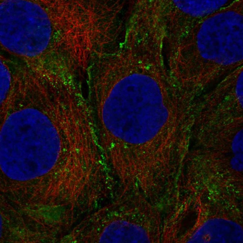 Anti-LEP Antibody