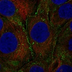 Anti-LEP Antibody