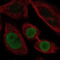 Anti-ZNF354C Antibody