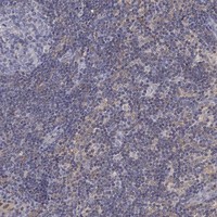 Anti-PLCB2 Antibody