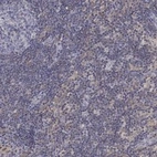Anti-PLCB2 Antibody