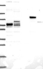 Lane 1: Marker [kDa] 250, 130, 95, 72, 55, 36, 28, 17, 10 | Lane 2: RT4 | Lane 3: U-251 MG | Lane 4: Human Plasma | Lane 5: Liver | Lane 6: Tonsil