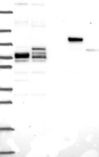 Anti-PLCB2 Antibody