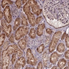 Anti-ZNF879 Antibody