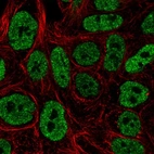 Immunofluorescent staining of human cell line RT-4 shows localization to nucleoplasm.