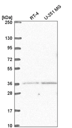 Anti-LDB2 Antibody
