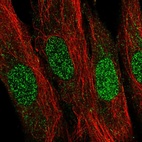 Immunofluorescent staining of human cell line BJ shows localization to nucleus.