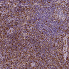 Anti-S100A4 Antibody