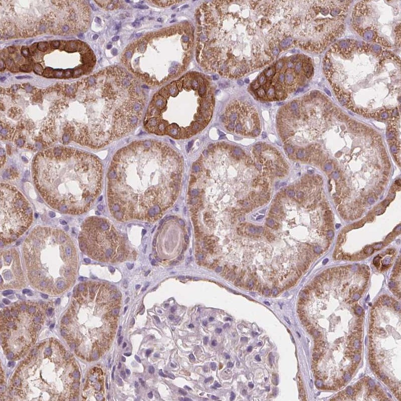 Anti-RAB20 Antibody